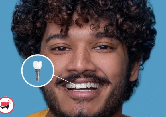 💰 How Much Does a Full Set of Teeth Implants Cost in India?