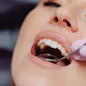 How to Clean Bacteria From Mouth The Ultimate Guide to Achieving Optimal Oral Hygiene