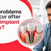 What Problems Can Occur After Dental Implant Surgery?
