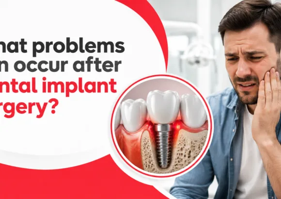 What Problems Can Occur After Dental Implant Surgery?
